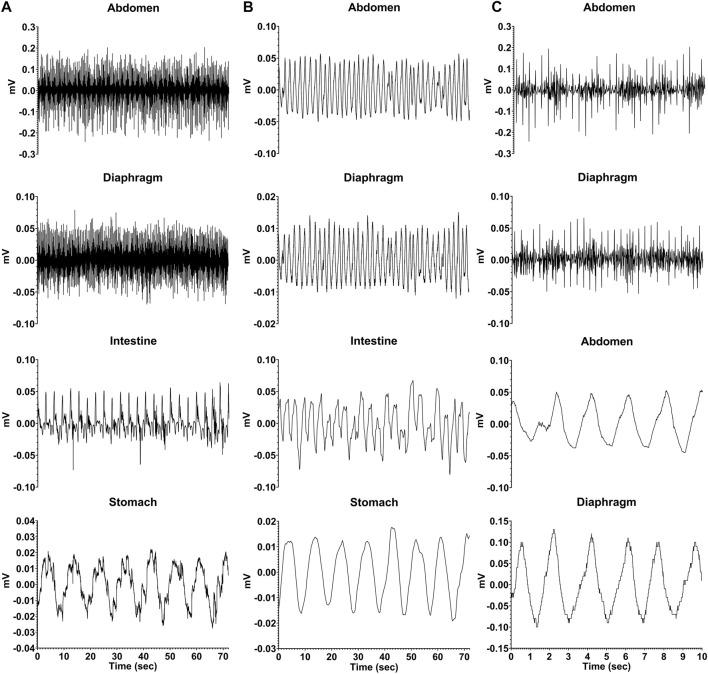 https://cdn.ncbi.nlm.nih.gov/pmc/blobs/f0c5/9892644/2cb89c5e0092/fphys-14-1077207-g002.jpg
