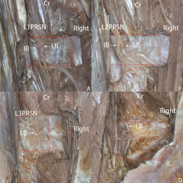 https://cdn.ncbi.nlm.nih.gov/pmc/blobs/f0c7/9573941/10b549369cf9/fcell-10-1019309-g002.jpg