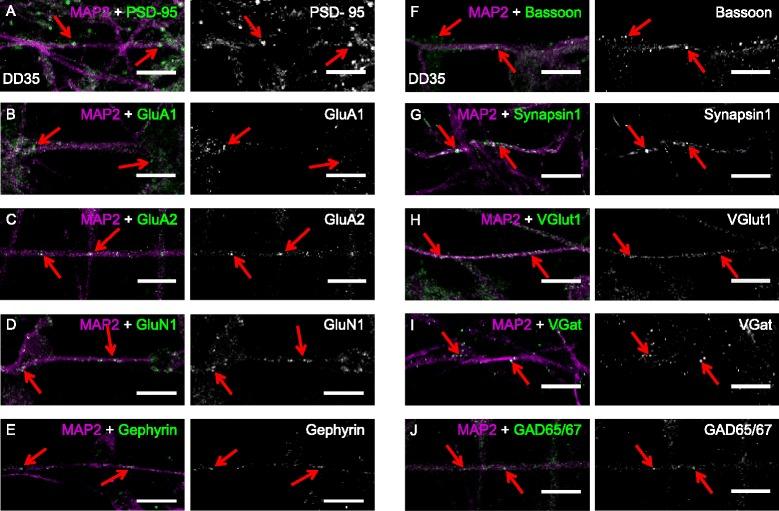 https://cdn.ncbi.nlm.nih.gov/pmc/blobs/f0c8/4546258/d4cf8975212d/13287_2015_136_Fig7_HTML.jpg