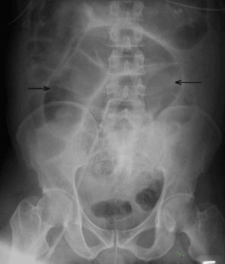 https://cdn.ncbi.nlm.nih.gov/pmc/blobs/f0c9/10998436/bb2737e51f2e/cureus-0016-00000055711-i02.jpg