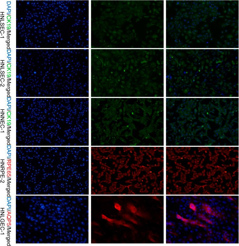 https://cdn.ncbi.nlm.nih.gov/pmc/blobs/f0ca/11064458/31da3fe137cf/mmcfigs2.jpg