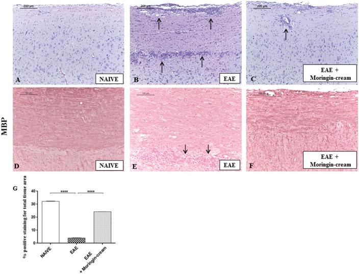 https://cdn.ncbi.nlm.nih.gov/pmc/blobs/f0cb/5555508/2b4c665a783d/10.1177_1744806917724318-fig3.jpg