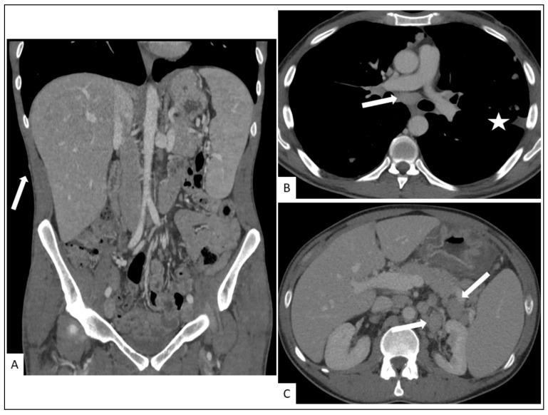 https://cdn.ncbi.nlm.nih.gov/pmc/blobs/f0cc/8657166/9c9d0d77f02f/cancers-13-05927-g006.jpg