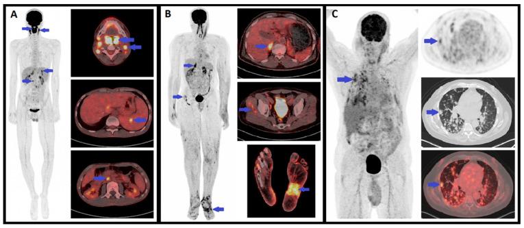 https://cdn.ncbi.nlm.nih.gov/pmc/blobs/f0cc/8657166/d648192c5d8f/cancers-13-05927-g009.jpg