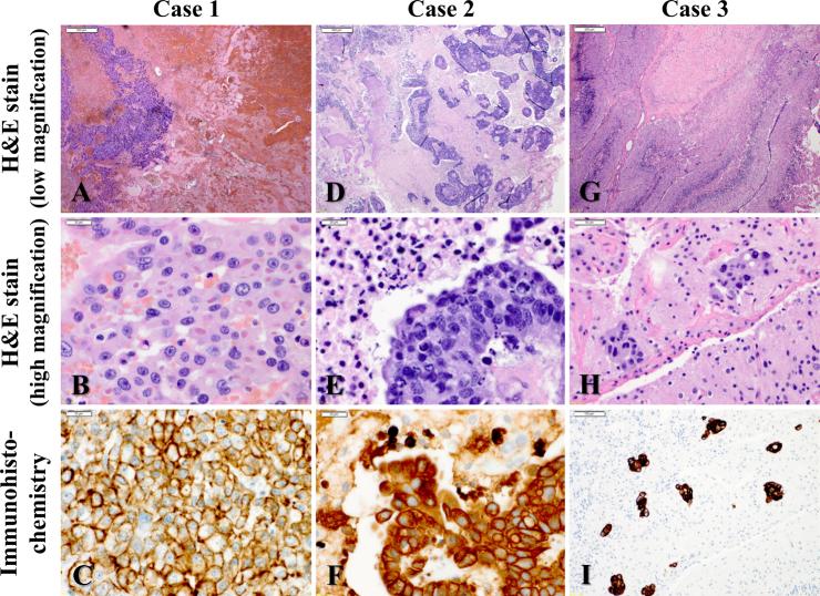 https://cdn.ncbi.nlm.nih.gov/pmc/blobs/f0ce/11833232/3515ddaa5d6b/CASE24737_figure_2.jpg