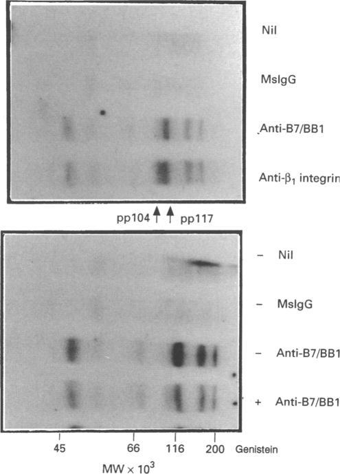 https://cdn.ncbi.nlm.nih.gov/pmc/blobs/f0d2/1383989/bd36b432eb62/immunology00063-0008-c.jpg