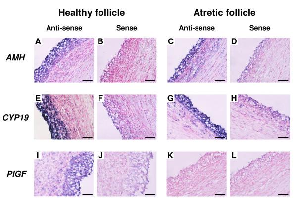 https://cdn.ncbi.nlm.nih.gov/pmc/blobs/f0d7/2833166/f5e196adc381/1477-7827-8-11-5.jpg