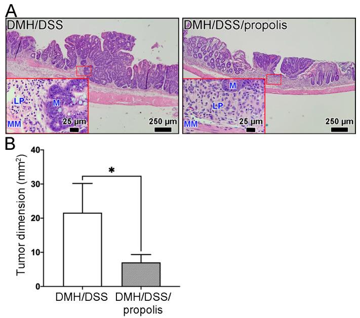 https://cdn.ncbi.nlm.nih.gov/pmc/blobs/f0e2/10648826/4f42469b8cb0/nutrients-15-04494-g004.jpg