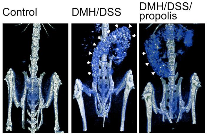https://cdn.ncbi.nlm.nih.gov/pmc/blobs/f0e2/10648826/a352b4e59de2/nutrients-15-04494-g002.jpg