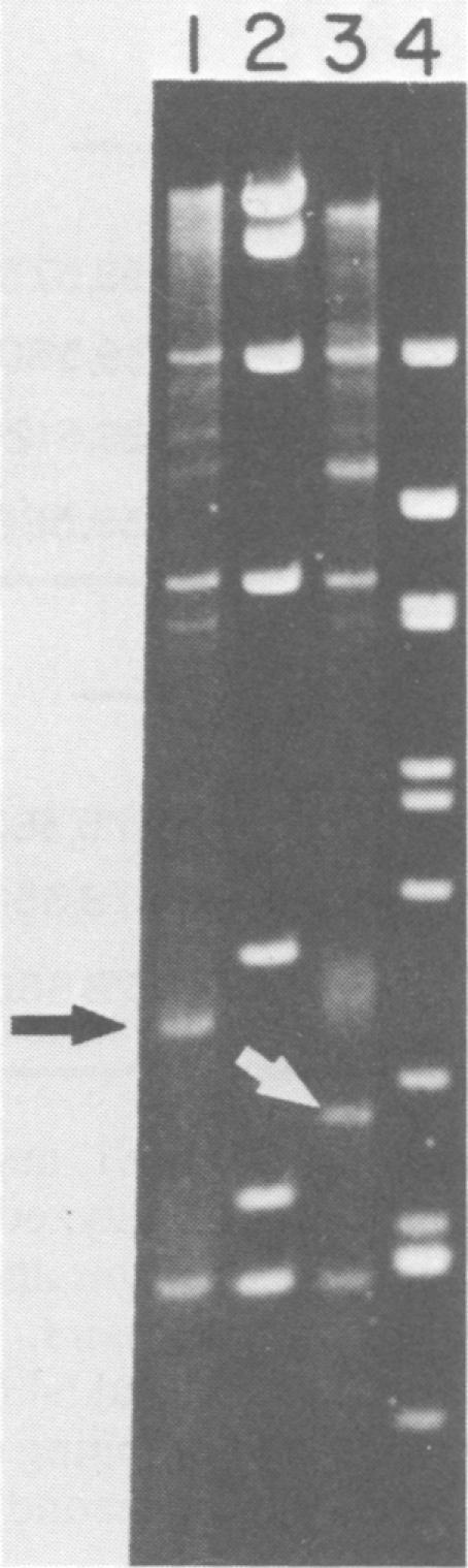 https://cdn.ncbi.nlm.nih.gov/pmc/blobs/f0e2/256160/bff769b00d0a/jvirol00155-0213-a.jpg