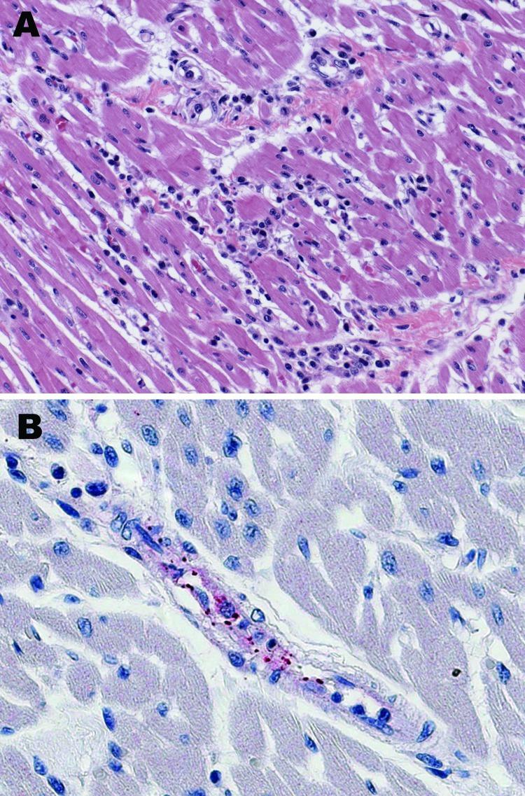 https://cdn.ncbi.nlm.nih.gov/pmc/blobs/f0f1/3375809/d87c45e14727/07-0931-F1.jpg