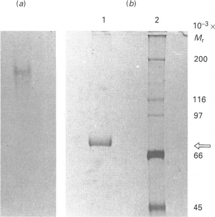 https://cdn.ncbi.nlm.nih.gov/pmc/blobs/f0fe/1130740/155ef5907908/biochemj00142-0087-a.jpg
