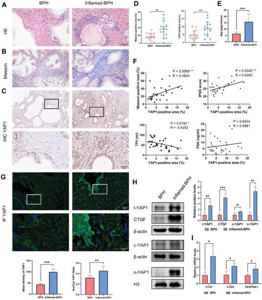 https://cdn.ncbi.nlm.nih.gov/pmc/blobs/f100/10837380/4546c3bd6b3e/ADVS-11-2304274-g001.jpg