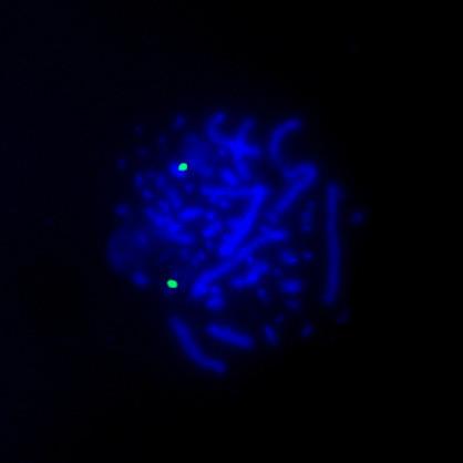 https://cdn.ncbi.nlm.nih.gov/pmc/blobs/f107/3135514/53bf70cd67ba/1477-3155-9-27-5.jpg