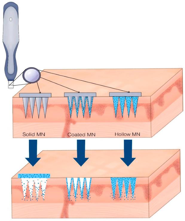 https://cdn.ncbi.nlm.nih.gov/pmc/blobs/f109/12295349/fc5cce8e46ca/ijms-26-06821-g004.jpg