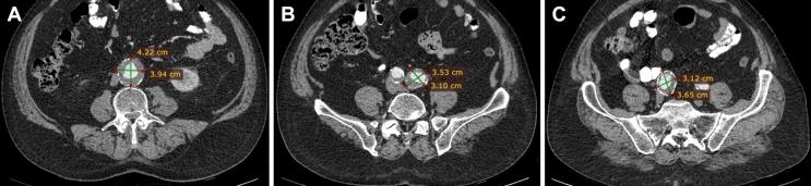 https://cdn.ncbi.nlm.nih.gov/pmc/blobs/f10d/6543130/d29409244aff/gr1.jpg