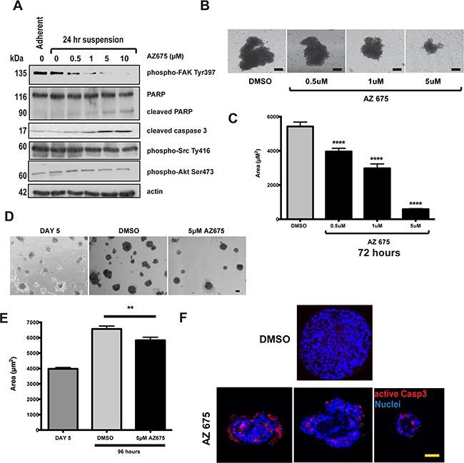 https://cdn.ncbi.nlm.nih.gov/pmc/blobs/f10f/5342556/c75927b944ce/oncotarget-07-70336-g006.jpg