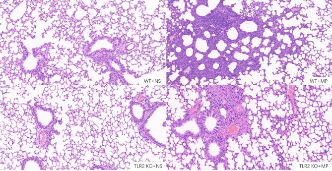 https://cdn.ncbi.nlm.nih.gov/pmc/blobs/f112/8968444/ea346e1047a4/fcimb-12-824027-g007.jpg
