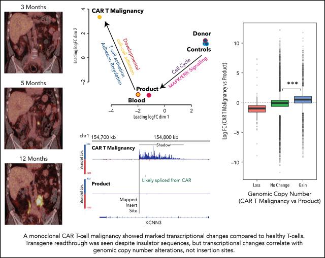 https://cdn.ncbi.nlm.nih.gov/pmc/blobs/f113/8532197/f261bf466719/bloodBLD2021010858absf1.jpg