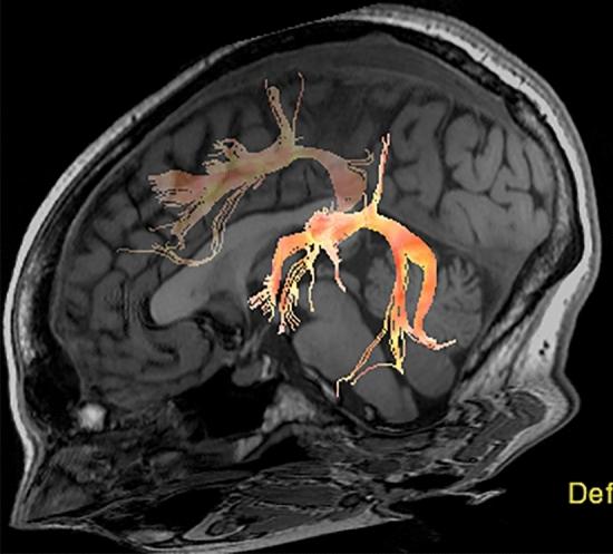 https://cdn.ncbi.nlm.nih.gov/pmc/blobs/f118/8536719/7e0b0de68729/41598_2021_490_Fig1_HTML.jpg