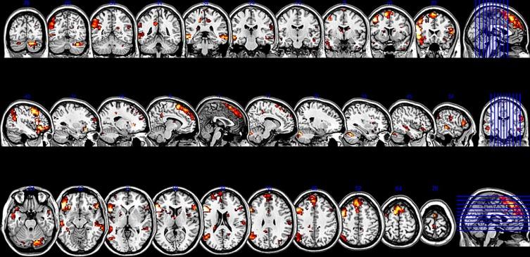 https://cdn.ncbi.nlm.nih.gov/pmc/blobs/f119/4009443/8d536a827798/fnhum-08-00228-g0002.jpg