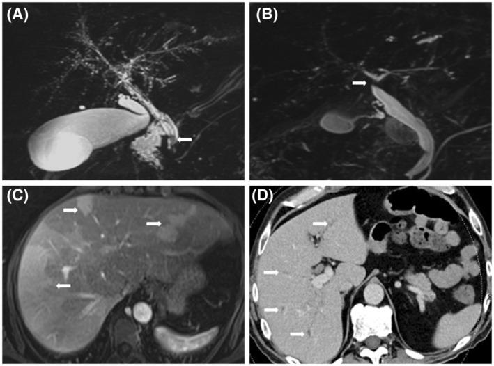https://cdn.ncbi.nlm.nih.gov/pmc/blobs/f119/9347407/648c0c53dcce/HEP-9999-0-g003.jpg