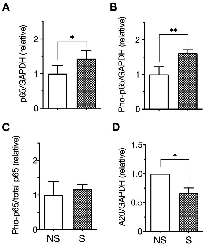 https://cdn.ncbi.nlm.nih.gov/pmc/blobs/f11a/9569556/7e303da2423c/ijms-23-11148-g002.jpg