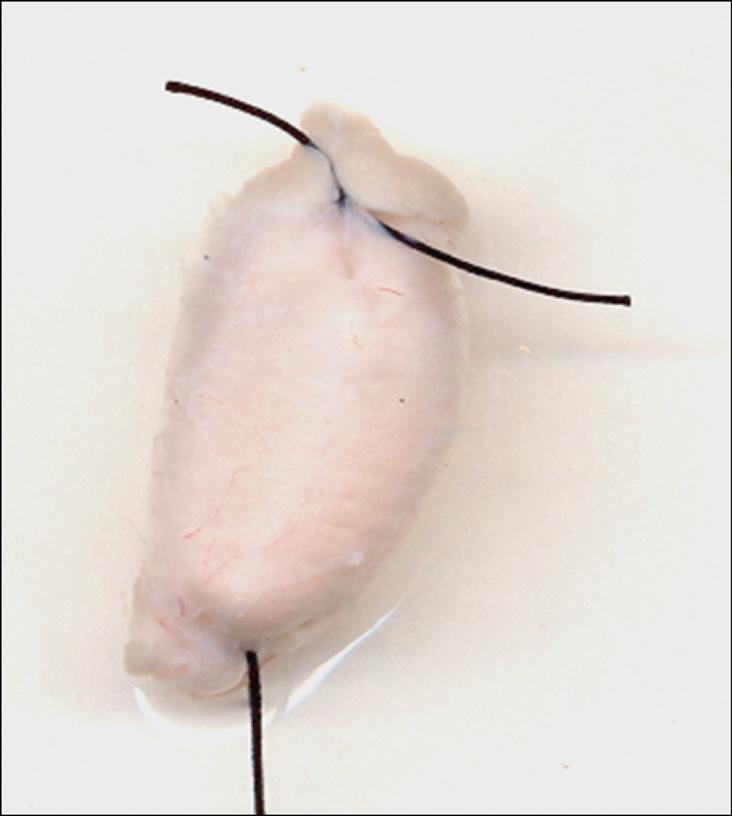 https://cdn.ncbi.nlm.nih.gov/pmc/blobs/f11e/2978390/1129db8efa8a/jnm-16-374-g001.jpg