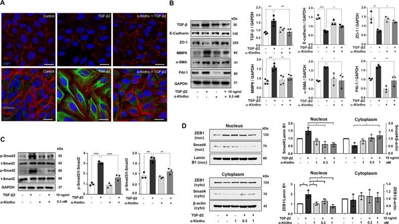 https://cdn.ncbi.nlm.nih.gov/pmc/blobs/f12c/10199917/f63d0afe49b7/41419_2023_5851_Fig4_HTML.jpg