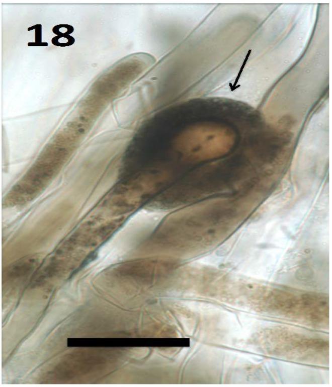 https://cdn.ncbi.nlm.nih.gov/pmc/blobs/f130/6164190/1d9644d05190/microorganisms-06-00095-g018.jpg