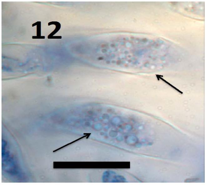 https://cdn.ncbi.nlm.nih.gov/pmc/blobs/f130/6164190/333c0717a78a/microorganisms-06-00095-g012.jpg