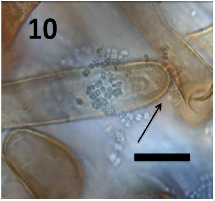 https://cdn.ncbi.nlm.nih.gov/pmc/blobs/f130/6164190/d75ada45f217/microorganisms-06-00095-g010.jpg