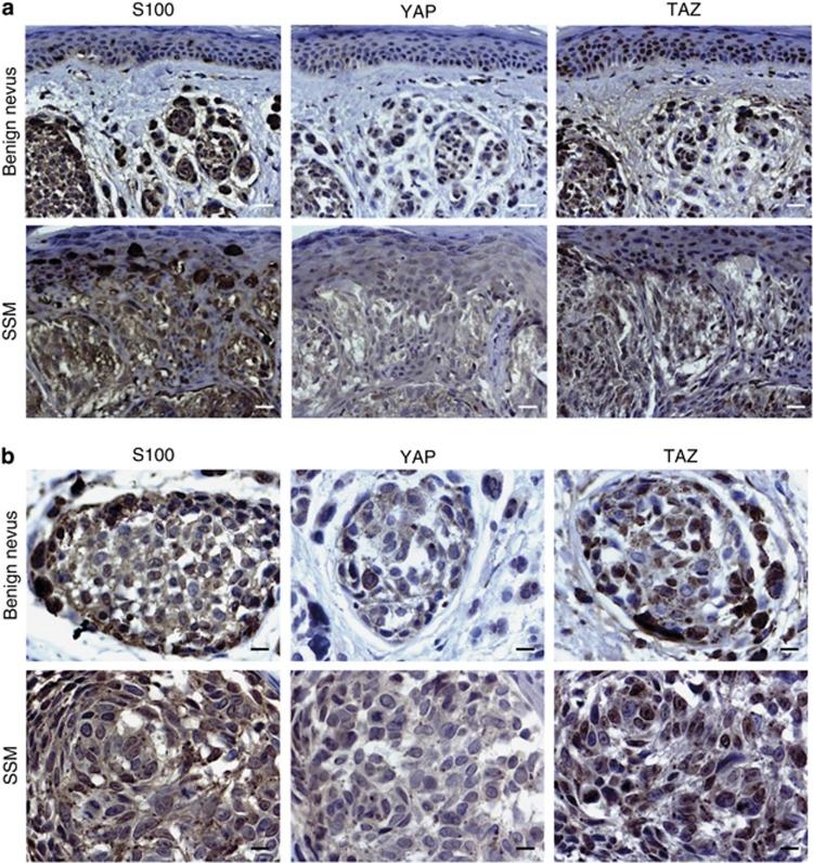 https://cdn.ncbi.nlm.nih.gov/pmc/blobs/f138/3938155/ea508d83101e/jid2013319f2.jpg