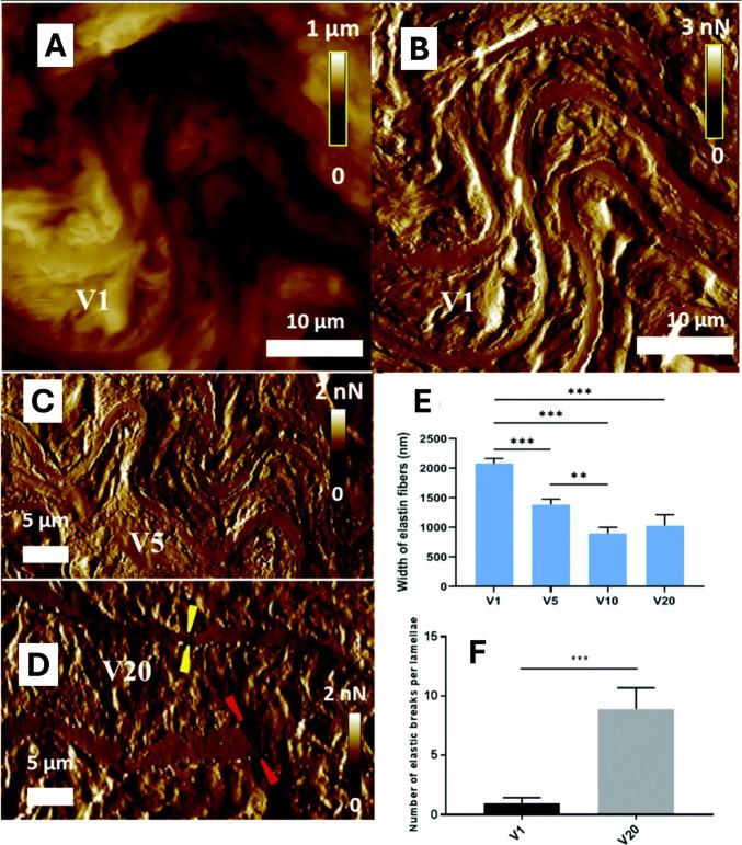 https://cdn.ncbi.nlm.nih.gov/pmc/blobs/f13d/12075069/2a723e463850/12551_2025_1306_Fig4_HTML.jpg
