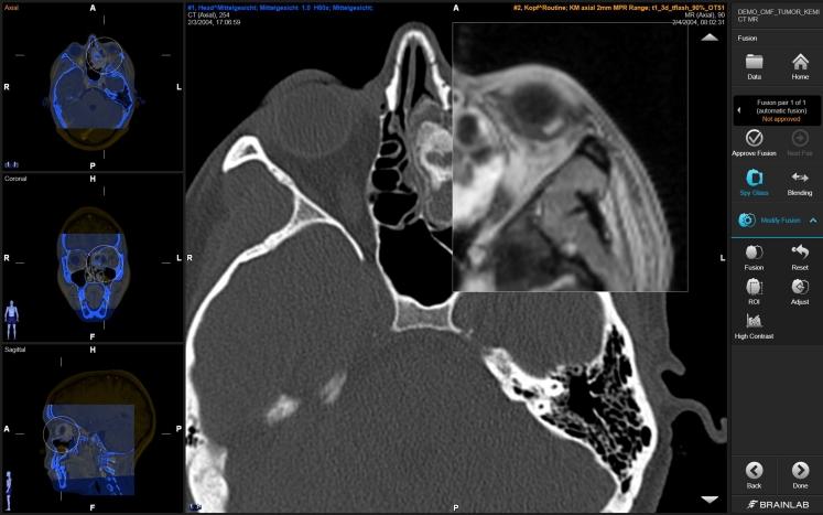 https://cdn.ncbi.nlm.nih.gov/pmc/blobs/f140/3627858/03e95686cebe/423_2013_1059_Fig4_HTML.jpg