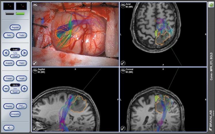 https://cdn.ncbi.nlm.nih.gov/pmc/blobs/f140/3627858/72af8215e90a/423_2013_1059_Fig5_HTML.jpg