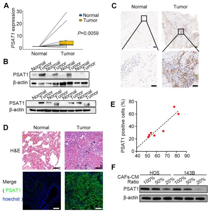 https://cdn.ncbi.nlm.nih.gov/pmc/blobs/f141/12223780/a6bc09c41d1c/ijbsv21p4153g004.jpg