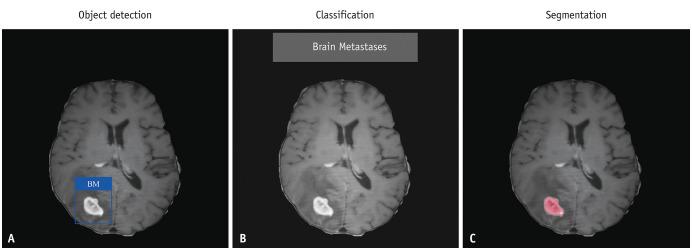 https://cdn.ncbi.nlm.nih.gov/pmc/blobs/f14b/10323413/feafcde4bb01/kjr-24-698-g002.jpg
