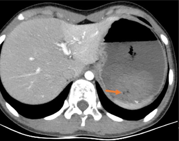 https://cdn.ncbi.nlm.nih.gov/pmc/blobs/f150/8891784/c3753c090281/WJCC-10-1966-g001.jpg