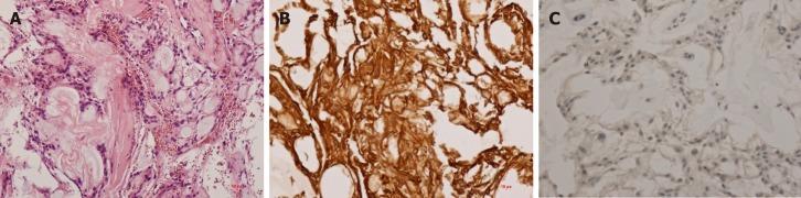 https://cdn.ncbi.nlm.nih.gov/pmc/blobs/f151/6547326/b111f6dcec66/WJCC-7-1142-g003.jpg