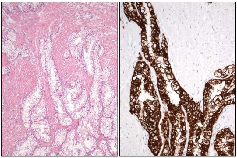 https://cdn.ncbi.nlm.nih.gov/pmc/blobs/f15e/11987958/0c555455eade/cancers-17-01173-g006.jpg