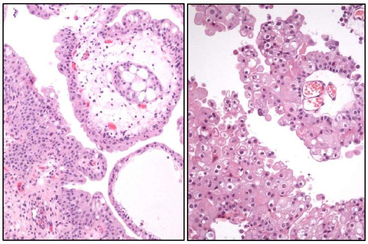 https://cdn.ncbi.nlm.nih.gov/pmc/blobs/f15e/11987958/129c86b911ab/cancers-17-01173-g010.jpg