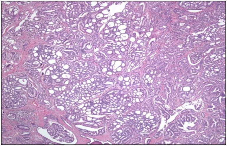 https://cdn.ncbi.nlm.nih.gov/pmc/blobs/f15e/11987958/13ceee4754cb/cancers-17-01173-g001.jpg