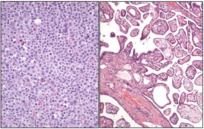 https://cdn.ncbi.nlm.nih.gov/pmc/blobs/f15e/11987958/1bdac6233a8a/cancers-17-01173-g004.jpg