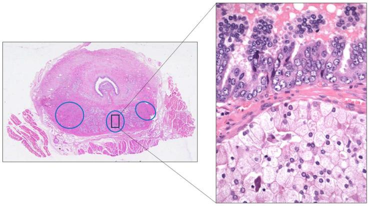 https://cdn.ncbi.nlm.nih.gov/pmc/blobs/f15e/11987958/2d036ba4f206/cancers-17-01173-g009.jpg