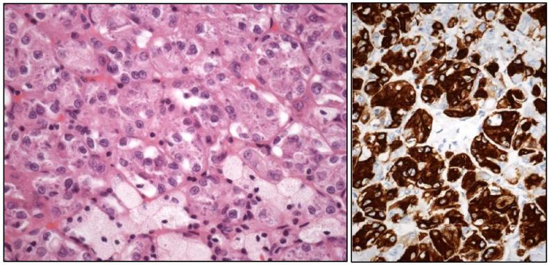 https://cdn.ncbi.nlm.nih.gov/pmc/blobs/f15e/11987958/424a80adf3cf/cancers-17-01173-g002.jpg