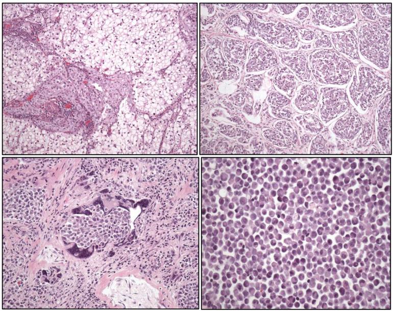 https://cdn.ncbi.nlm.nih.gov/pmc/blobs/f15e/11987958/4bafeb60295a/cancers-17-01173-g003.jpg