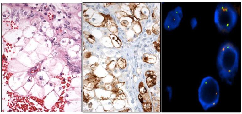 https://cdn.ncbi.nlm.nih.gov/pmc/blobs/f15e/11987958/72ea7e69ce84/cancers-17-01173-g007.jpg