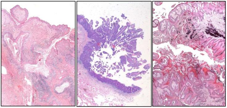 https://cdn.ncbi.nlm.nih.gov/pmc/blobs/f15e/11987958/896cee745109/cancers-17-01173-g005.jpg