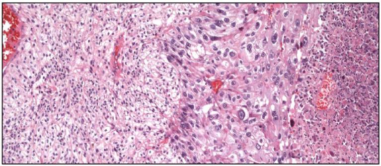 https://cdn.ncbi.nlm.nih.gov/pmc/blobs/f15e/11987958/943f1cf5b280/cancers-17-01173-g012.jpg